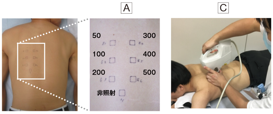 健常者における波長222nm 紫外線照射